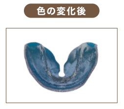 プレオルソの使用後はお水で優しく洗ってください。