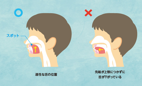 プレオルソのお手入れ方法
